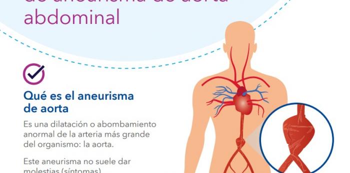 Especialistas en Angiología y Cirugía Vascular promueven una campaña para la detección de aneurismas de aorta abdominal